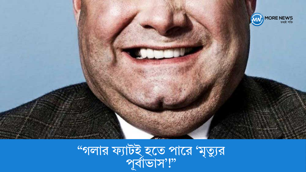 “গলার ফ্যাটই হতে পারে ‘মৃত্যুর পূর্বাভাস’!”