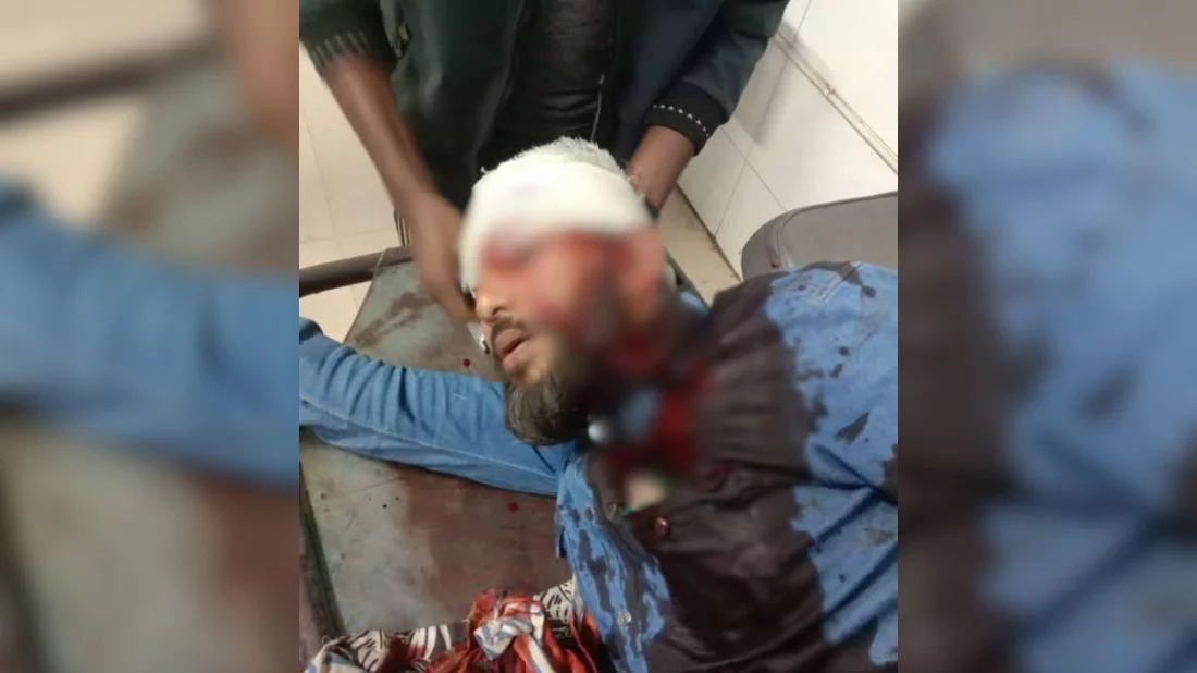 NCP leader shot in Khulna, hospitalised in critical condition