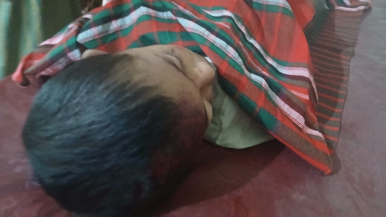 তেঁতুলিয়ায় অটোরিকশার ধাক্কায় এক শিশু মৃত্যু