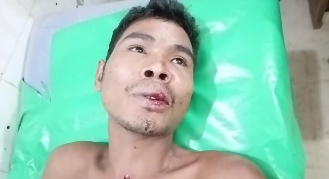 দুর্গাপুরের সীমান্তে মাদকবিরোধী অভিযান, সহিংসতায়-আহত ১