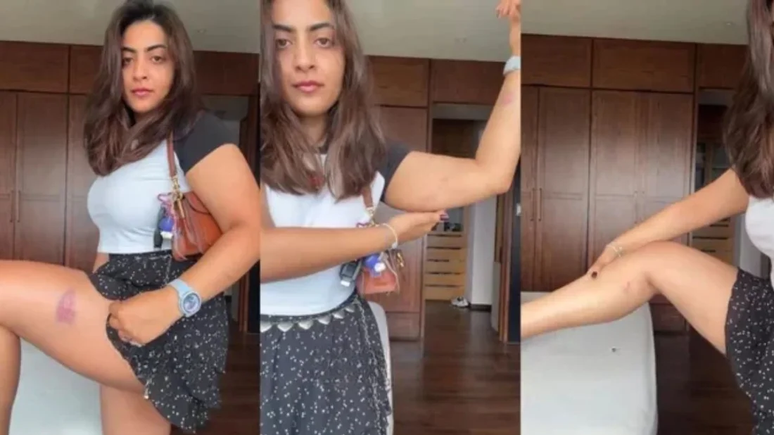 Aamir Khan's niece reveals injury marks after detention in Mumbai
